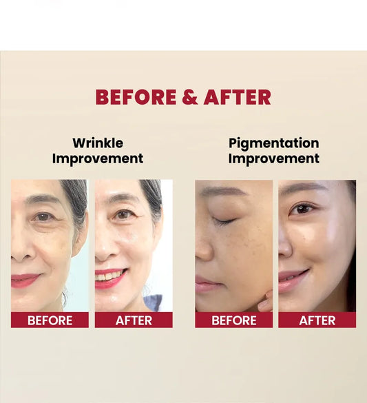 KSECRET – سيروم سيول 1988: ريتينال ليبوسوم 2% + الجنسنغ الأسود 30 مل | صنع في كوريا الجنوبية